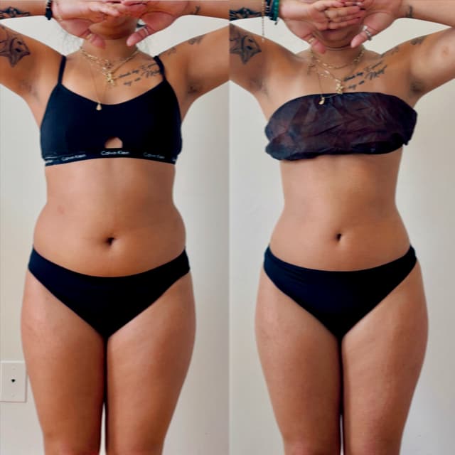 BareFruit Sculpt Transformation at BareFruit Body Lab in Alexandria, VA